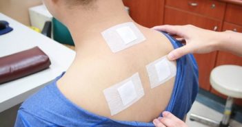 中国过三伏 方式多种多样 man having sanfu plasters stuck on back in china